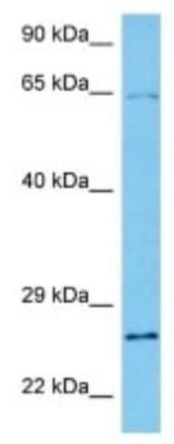 RCAN3 Rabbit anti-Human, Polyclonal, Novus Biologicals 100 &mu;g | Buy Online | Novus Biologicals | Fisher Scientific